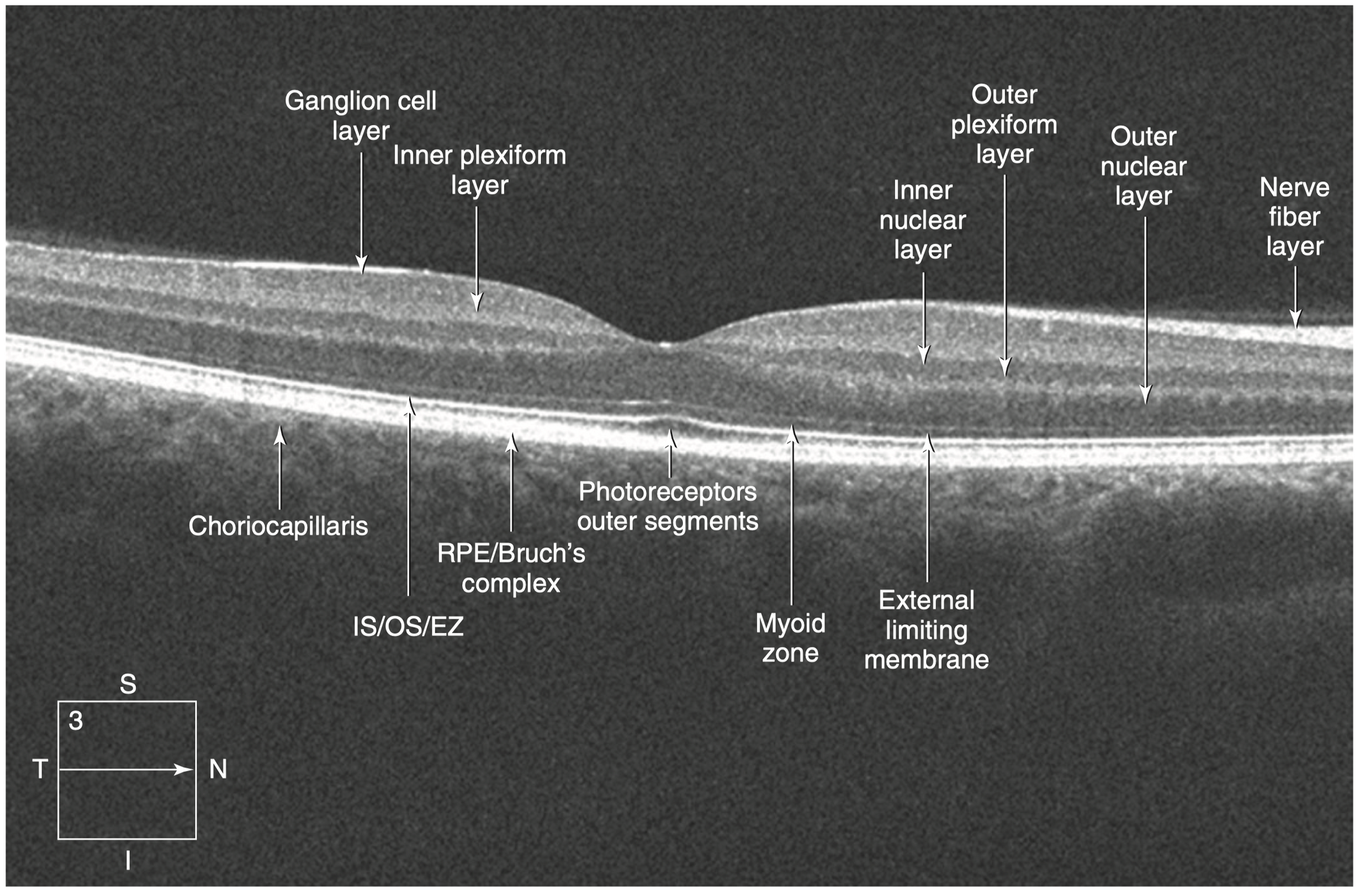 retinal layers oct