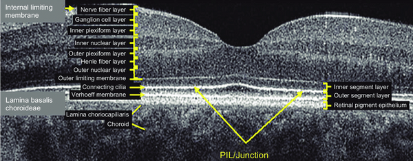 Different retinal layers in OCT